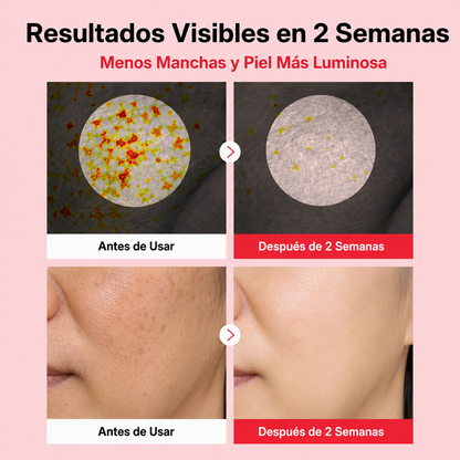 2x1 LumiSkin™ — Crema Anti-Manchas Iluminadora Facial